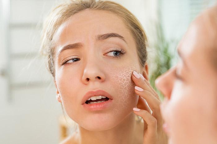 Keeping Your Skin Protected and Nourished All Winter Long