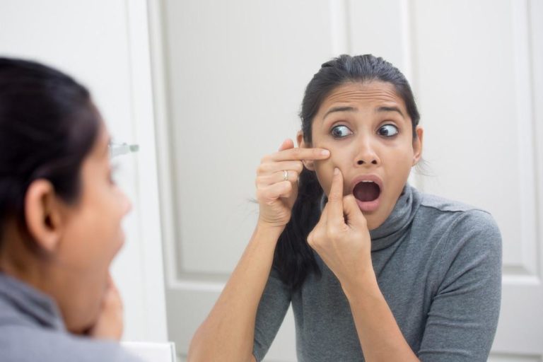 What is the Best Moisturizer for Acne Prone Skin?