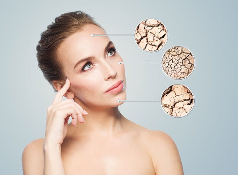 What Causes Dry Skin
