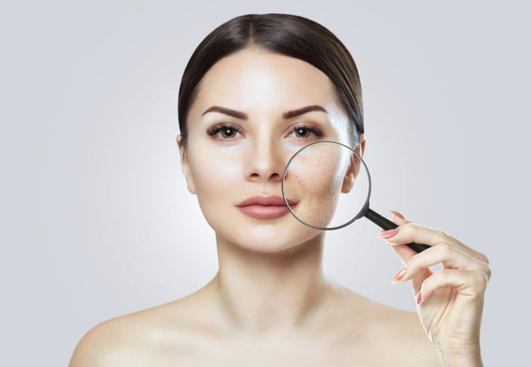 Cover Up Scars with the Best Makeup for Pitted Acne Scars