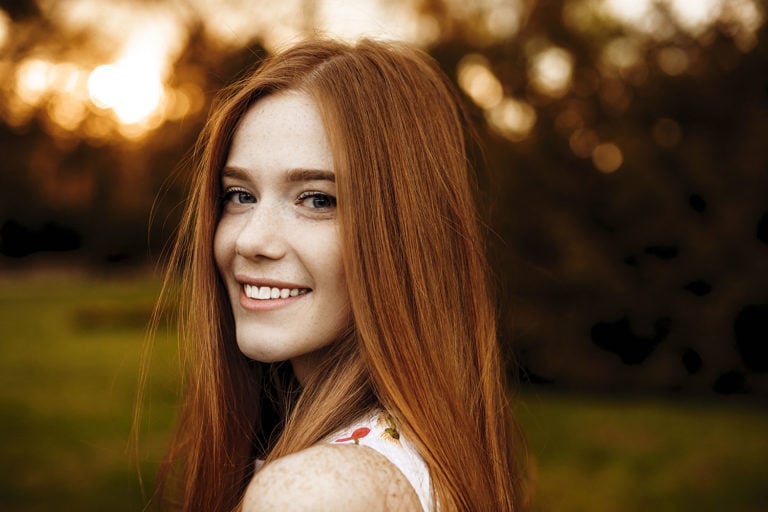 5 Tips for Freckles In Summer image of young woman with freckles