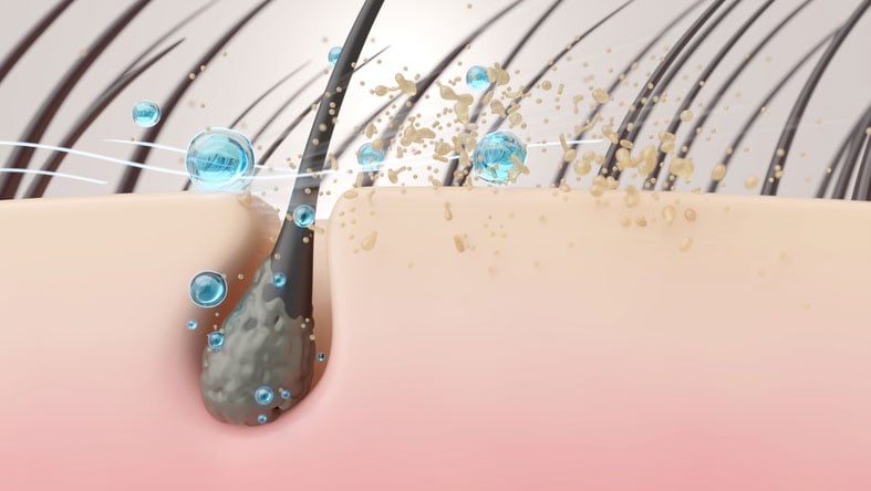 Beauty Blog Sebum Removal and Scalp Cleansing with Shampoo Particles 3D Cross-Section stock photo