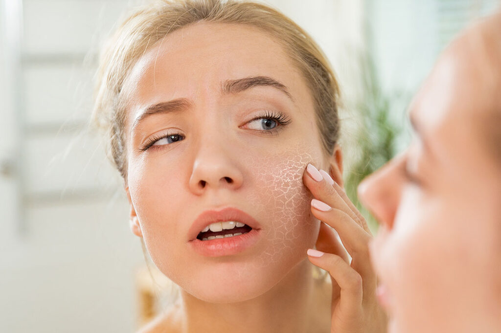 Beauty Blog dry irritated skin stock photo