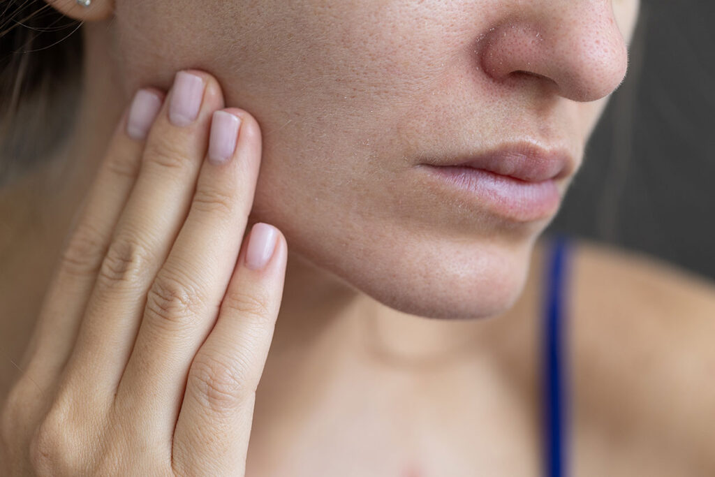 Beauty Blog Young woman with a problem dry skin and with big pore stock photo