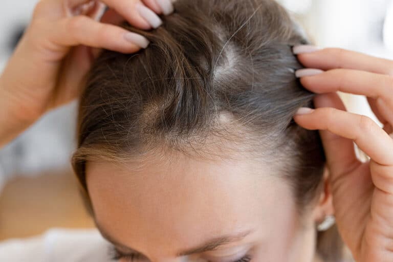 Scalp Care for Healthier Hair Growth