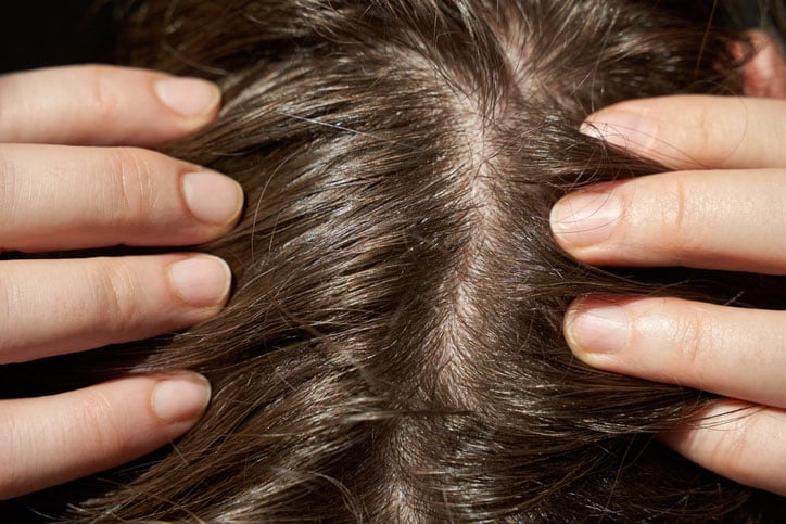 Beauty Blog Close-up of brown hair and scalp with caucasian hands parting strands for hair stock photo