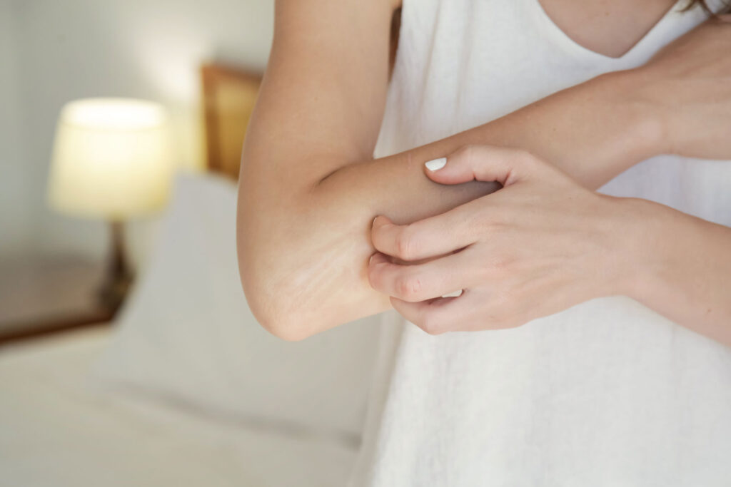 Beauty Blog Winterizing dry itchy skin on the elbow area stock photo