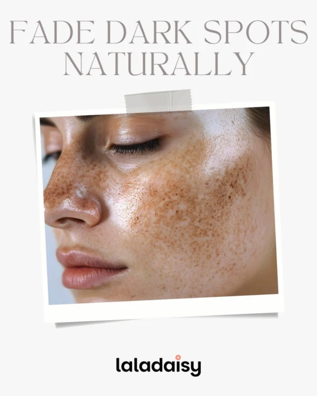 🌸 Hyperpigmentation is more than skin deep. 
Niacinamide helps target the process that creates dark spots — supporting a smoother, brighter, more balanced complexion with continued use. 💧✨

No harsh bleaching. No quick-cover solutions. 
Just science-backed skincare that works with your skin naturally.

Read more at the link in our bio.

#Niacinamide #Hyperpigmentation #DarkSpots #SkincareRoutine #GlowingSkin #EvenSkinTone #SkinCareTips #HealthySkin #BeautyRoutine #LaLaDaisy