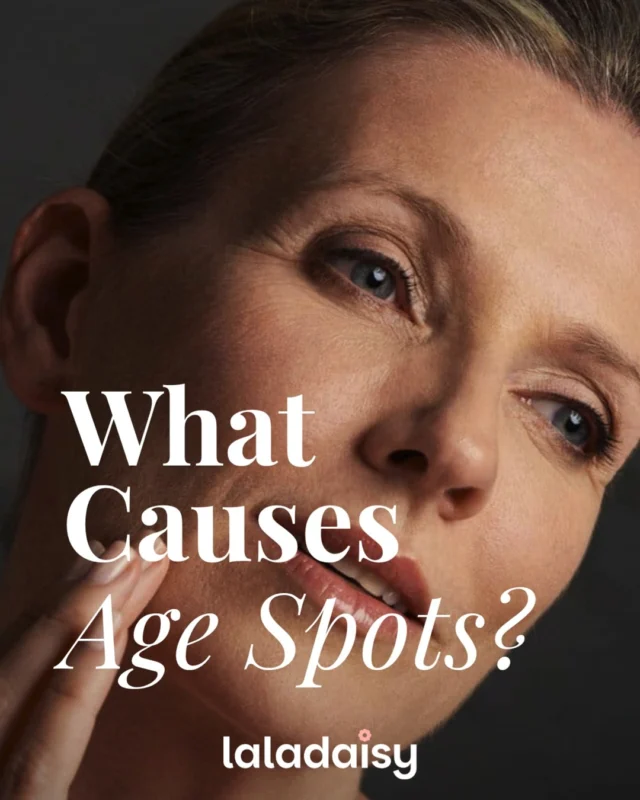 🌸 Age spots don't appear overnight—they develop over years of sun exposure and natural skin aging. Understanding what causes them is the first step toward preventing new spots and keeping your skin looking brighter and healthier.
Discover what causes age spots, how to help prevent them, and simple skincare habits that can make a difference.

✨ ✨ Read more in bio / link:
https://bit.ly/4bOmsXy

#AgeSpots #SkincareTips #HealthySkin #SunDamage #DarkSpots #SkinCareRoutine #AntiAgingSkin #GlowingSkin #SkinHealth #LaLaDaisy